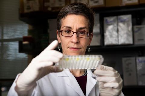 Assistant professor Gillian Beamer, who studies tuberculosis infection, examines samples in the lab. 